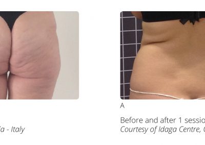 Casi Clinici Completi