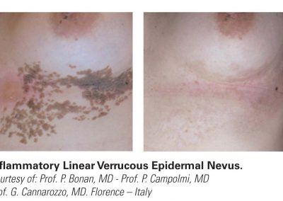 Smartxide2 Dot RF Applicazioni 6